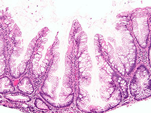Gastrointestinal Pathology Slide Image