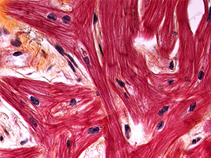 Slide image of heart tissue - full